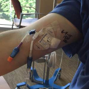 My PICC line from June. Note the 2 dangly things (lumens).