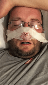 My Hannibal Lecter pose when my nose wouldn't stop bleeding.